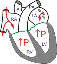cardiac anatomy - atrial contraction