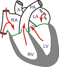cardiac anatomy - rapid ejection