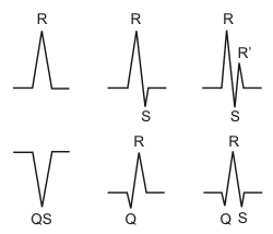 electrocardiogram QRS nomenclature