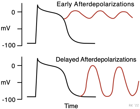 Afterdepolarizationsd