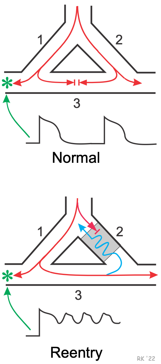 Reentry model