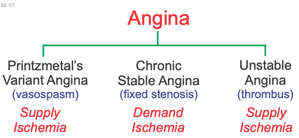 Types of angina