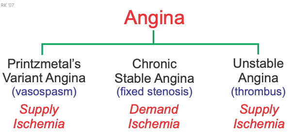 cv-physiology-angina