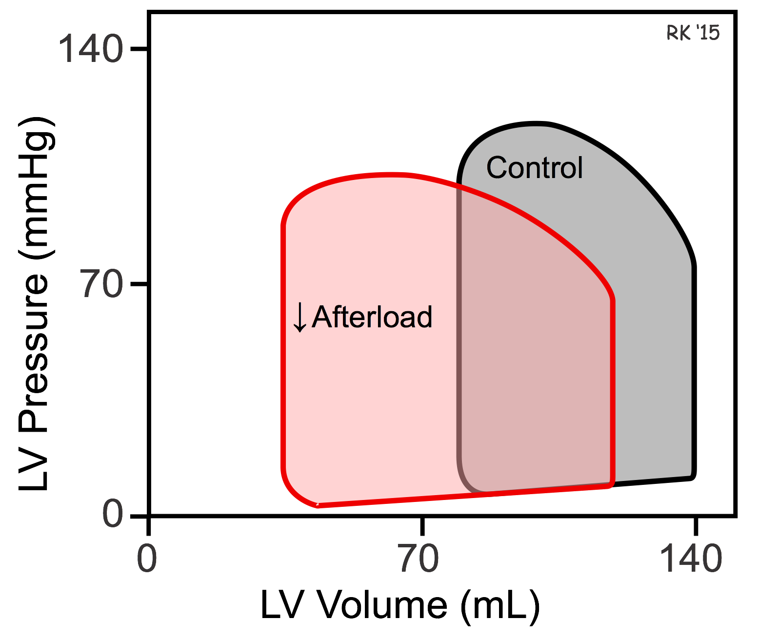 Afterload effects on ventricular pressure-volume loop