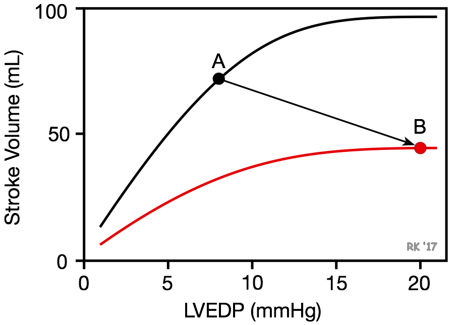 Effects of systolic dysfunction on ventricular Frank-Starling curve