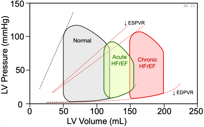 HFrEF pressure-volume loops