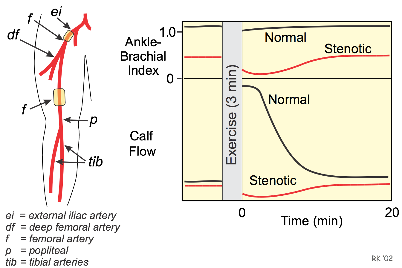 Hemodynamics of multiple arterial stenosis