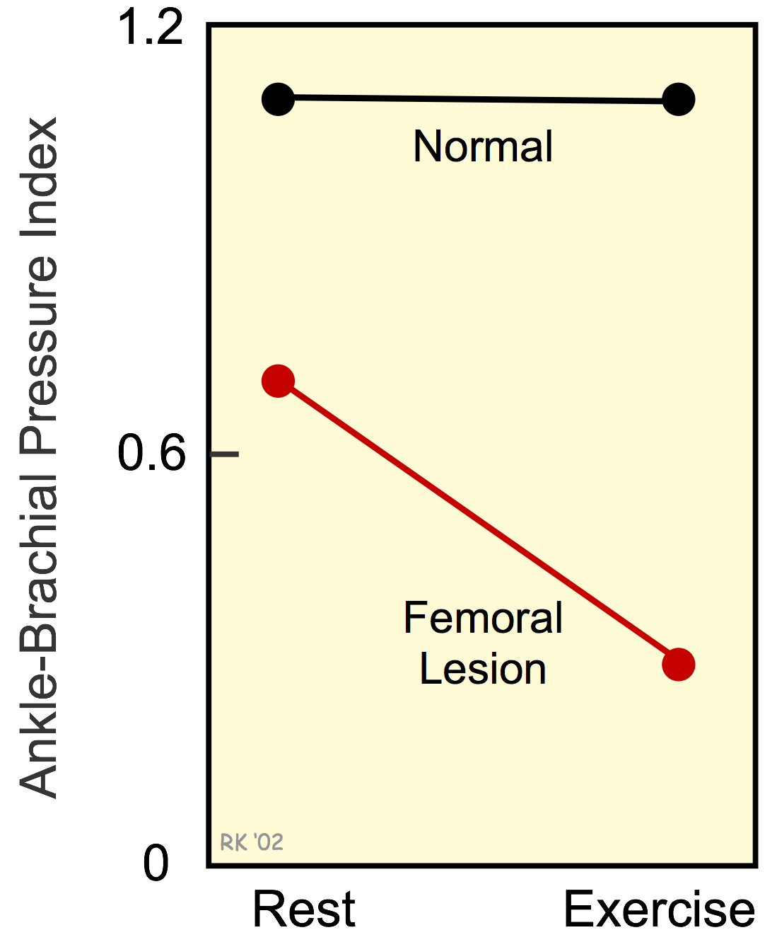 Ankle-brachial pressure index